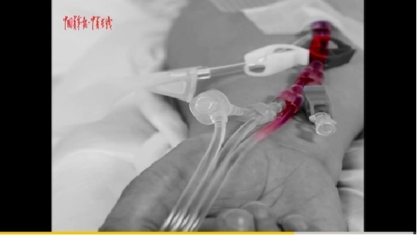 【中国梦微电影】《红》：女大夫自捐造血干细胞扶持白血病东谈主